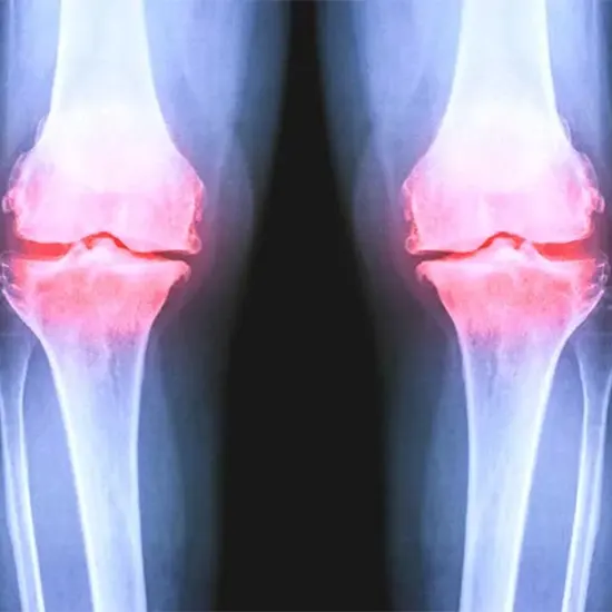 What Is The Role Of X-Ray In Knee Joint Injury?